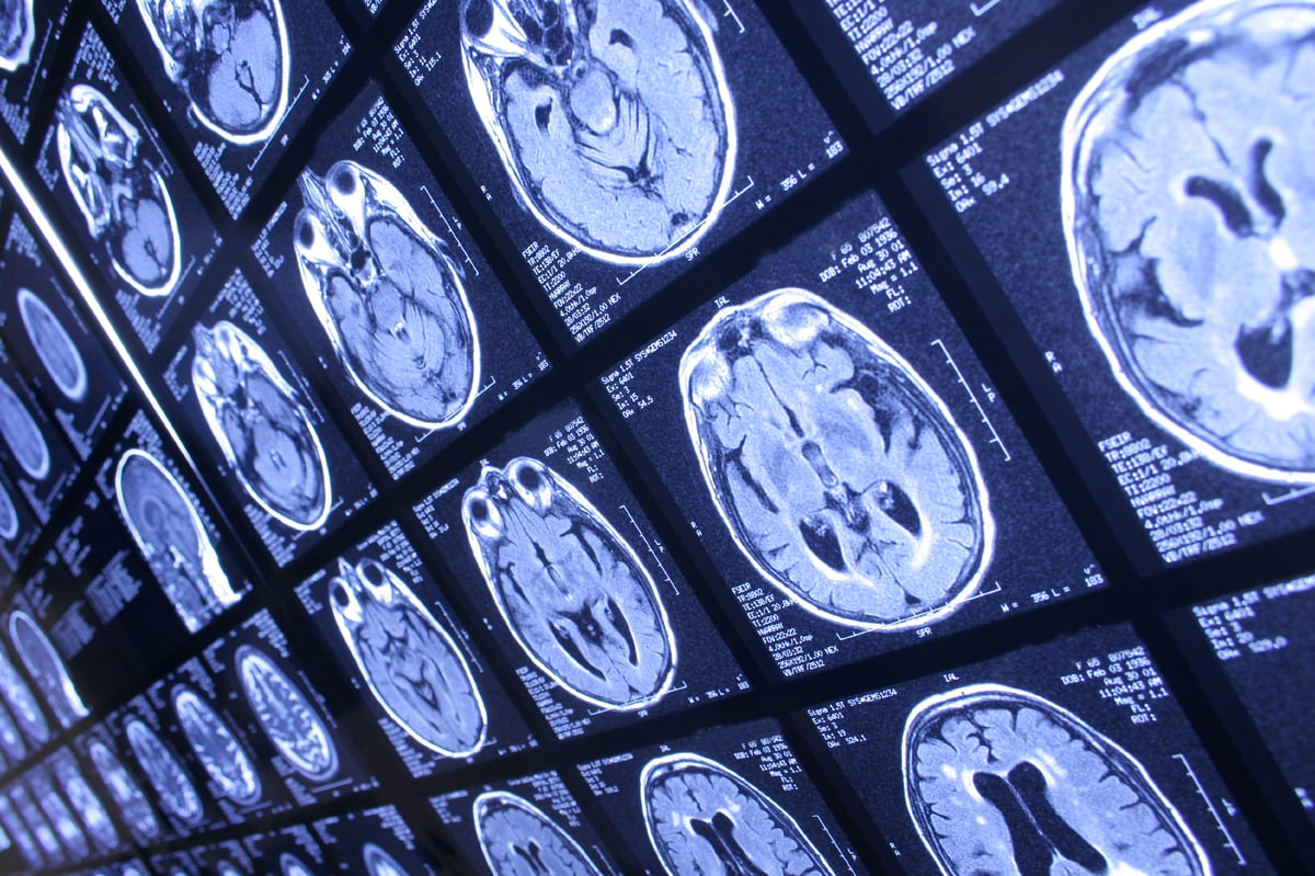 ECRI Helps You Manage GE Healthcare Omnipaque Contrast Dye Shortages