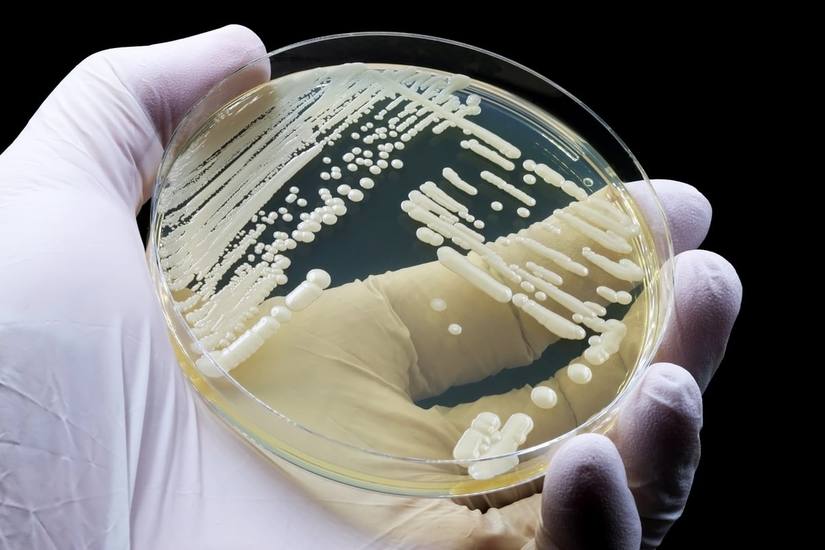 Candida Auris Cases Are on the Rise. How Can Infection Prevention Respond?